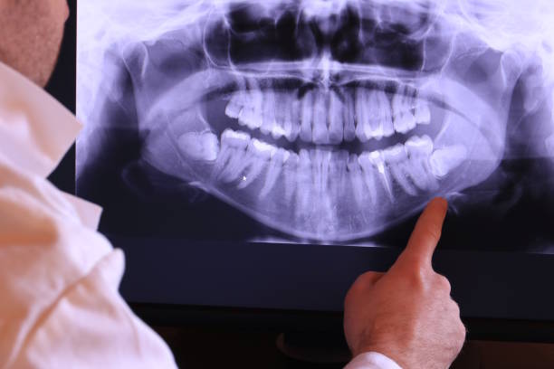 Best Emergency TMJ Treatment in Springfield, MA