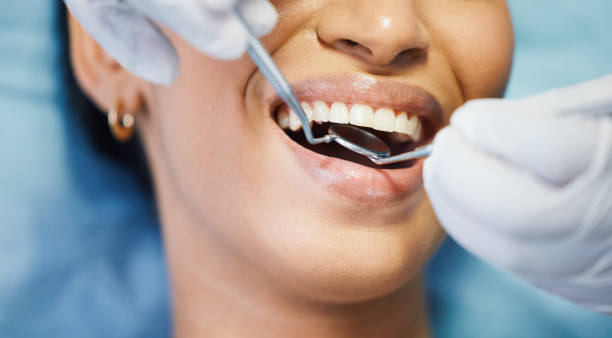 Best Emergency Dental Care for Broken or Chipped Teeth in Springfield, MA