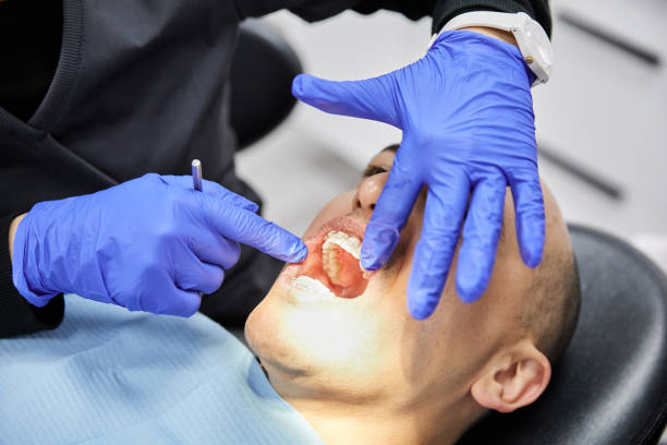 Best Emergency Denture Repair in Springfield, MA