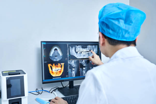 Best Emergency Treatment for Dental Infections or Abscesses in Springfield, MA